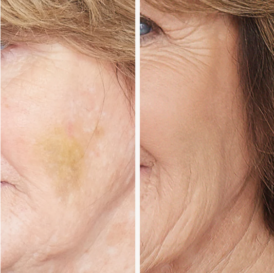 Corrective Colors Concealer Palette